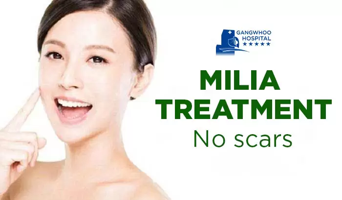 milia treatment