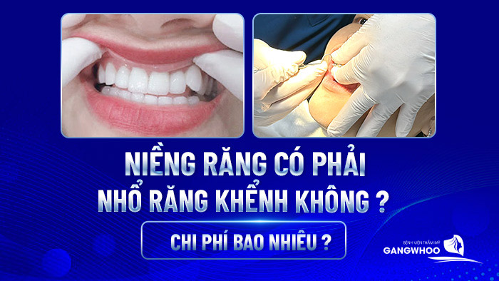 nieng rang co phai nho rang khenh khong 2