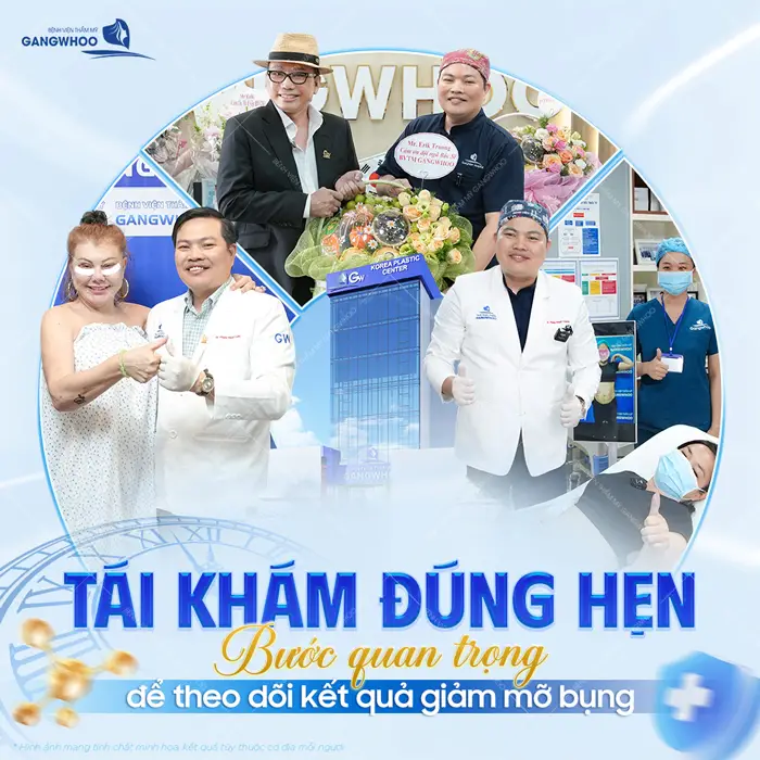 Tái khám đúng hẹn bước quan trọng để theo dõi kết quả giảm mỡ bụng 