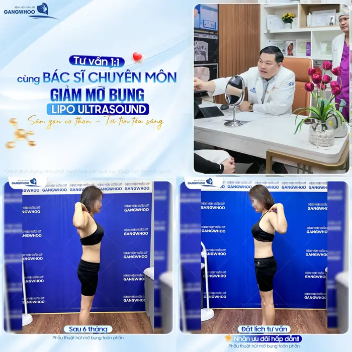 Tư vấn cùng bác sĩ chuyên môn sau giảm mỡ bụng Lipo Ultrasound săn gọn eo thon, tự tin tỏa sáng