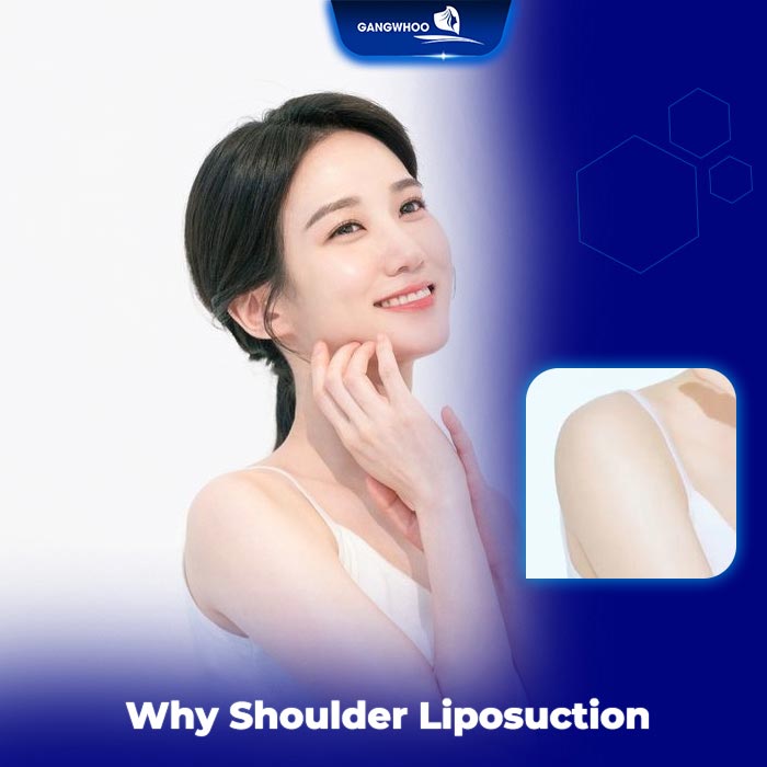 uu diem hut mo vai en