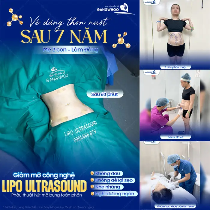 Về dáng thon nuột sau 7 năm làm mẹ 2 con ở Lâm Đồng kết quả cải thiện bụng đẹp eo thon, đẹp gọn và thon thả