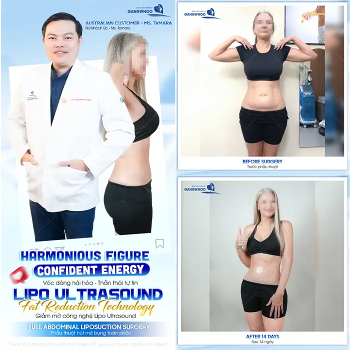 Nàng GenZ nâng tầm tự tin có màn thay đổi ngoạn mục sau 3 tháng trùng tu vòng 1