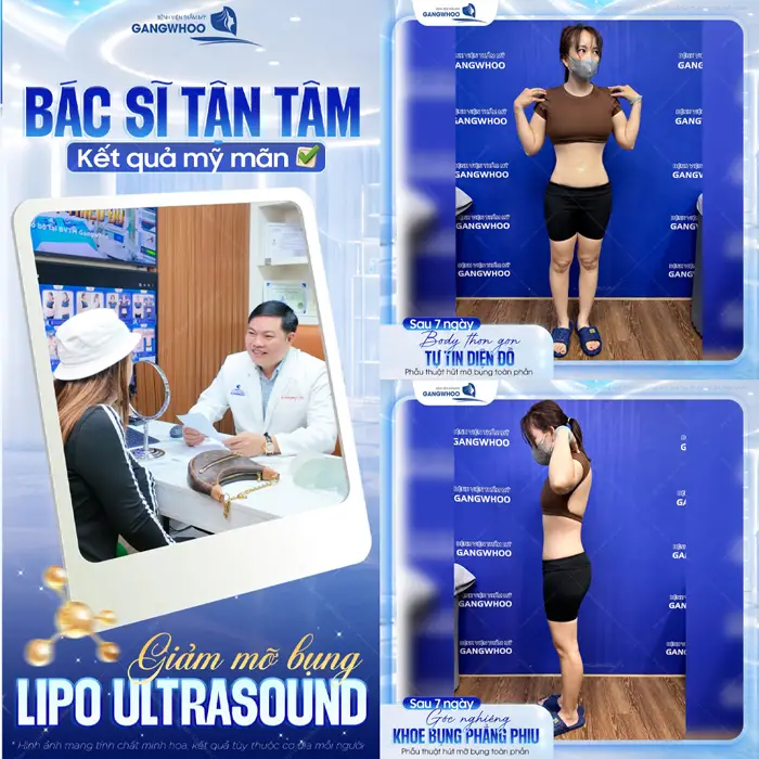 Bác sĩ tận tâm kết quả mỹ mãn sau giảm mỡ bụng Lipo Ultrasound hiện đại 