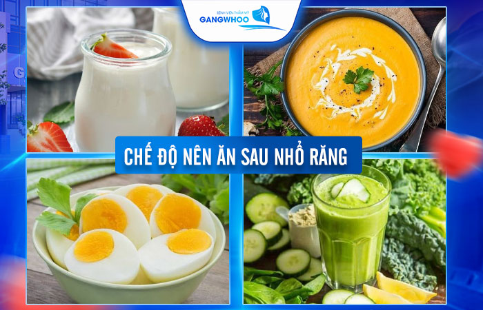 Nhổ Răng Xong Ăn Cơm Được Không