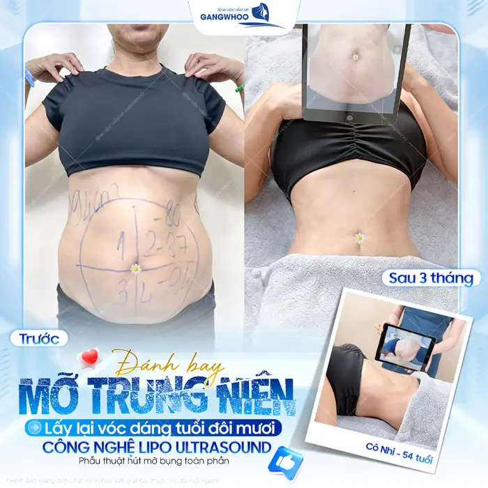 Tạm biệt bụng mỡ cứng đầu khách trung niên lấy lại vóc dáng trẻ đẹp tuổi đôi muôi chỉ sau 3 tháng đã hoàn toàn khác biệt đến bất ngờ