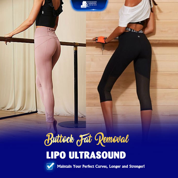 Buttock fat removal