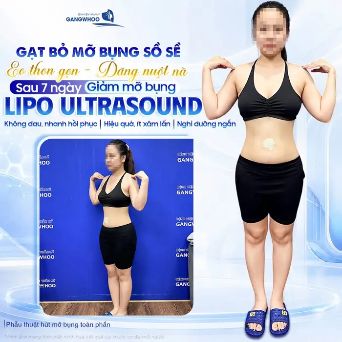 Gạt bỏ mỡ bụng sồ sề eo thon gọn, dáng thon nuột sau 7 ngày giảm mỡ đã hoàn toàn khác biệt
