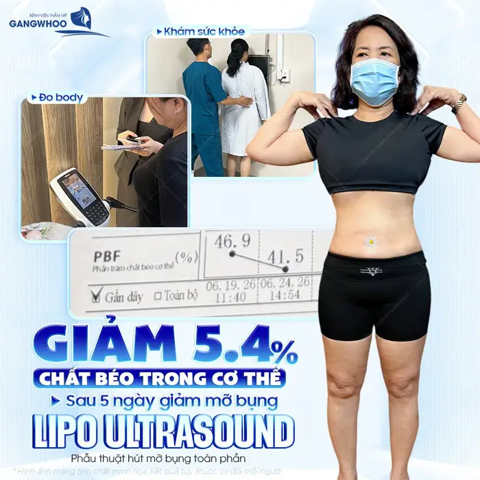 Sau 5 ngày giảm mỡ bụng Lipo Ultrasound giảm đến 5,4% chất béo trong cơ thể 