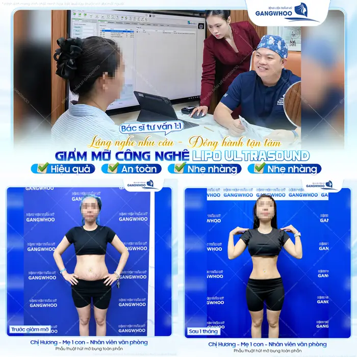 Giảm mỡ công nghệ Lipo Ultrasound hiệu quả, an toàn và nhẹ nhàng sau thực hiện 