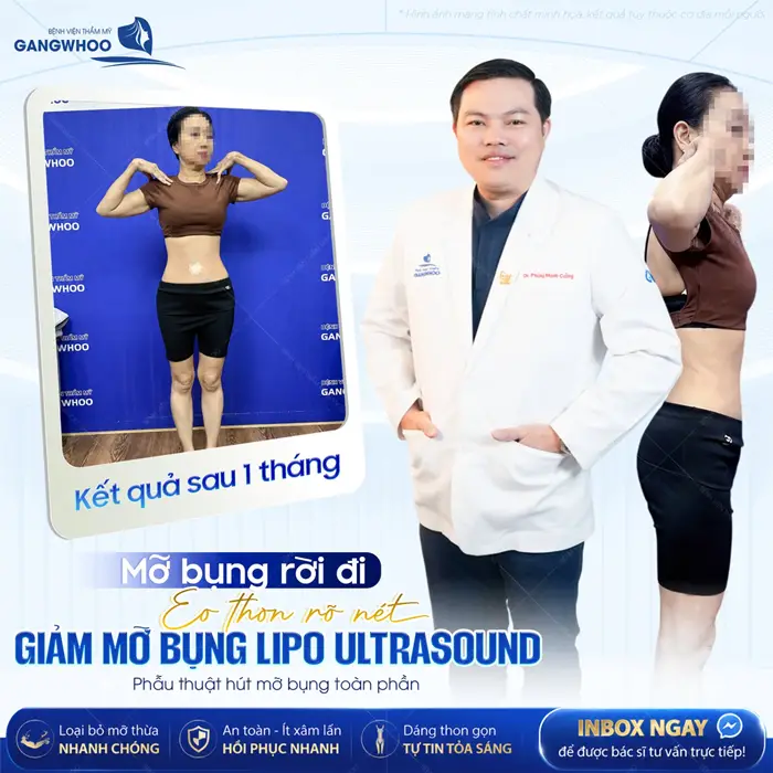 Mỡ bụng rời đi eo thon rõ nét giảm mỡ bụng Lipo Ultrasound kết quả sau 1 tháng tái khám đã đẹp xuất sắc