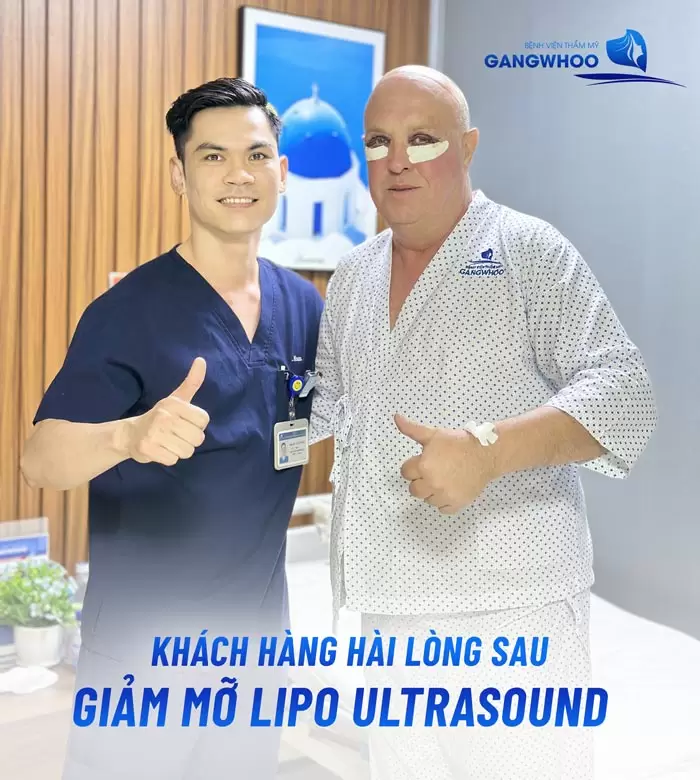 Hút Mỡ Bụng Bao Lâu Hồi Phục Hoàn Toàn? Bác Sĩ Giải Đáp 4 Khách hàng quốc tế hài lòng vì kết quả hút mỡ hiệu quả và nhanh hồi phục