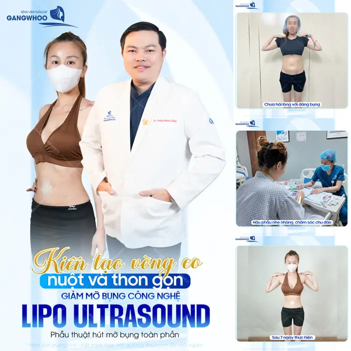 Kiến tạo vòng eo nuột nà và thon gọn với công nghệ giảm mỡ Lipo Ultrasound hiện đại