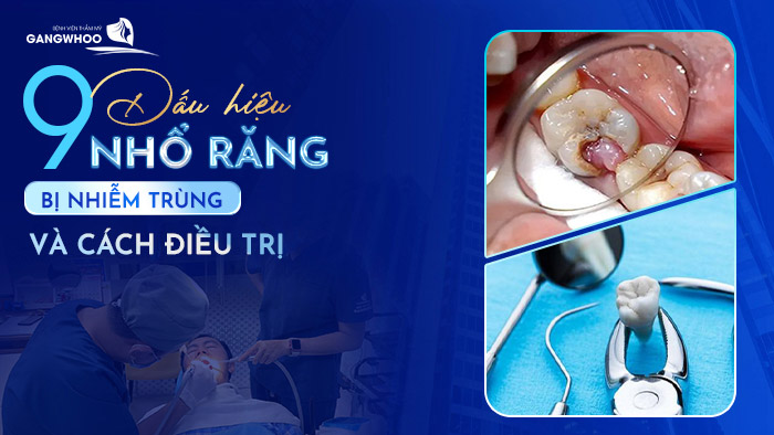 nho rang bi nhiem trugn