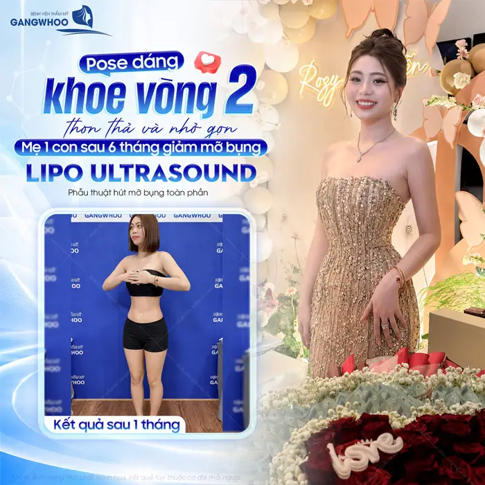 Tự tin khoe dáng vòng 2 đẹp xuất sắc sau khi thực hiện giảm mỡ bụng Lipo Ultrasound