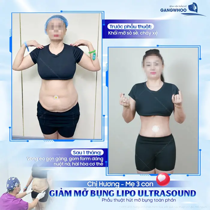 Sau 1 tháng vòng eo gọn gàng, gom form dáng nuột nà, hài hòa với cơ thể đẹp nuột nà đầy quyến rũ