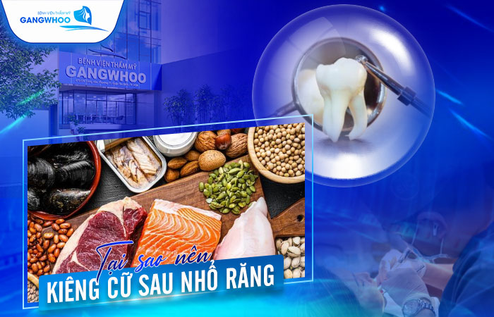 Nhổ Răng Khôn Kiêng Gì