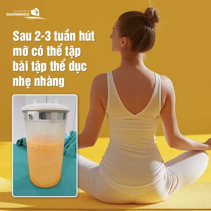 Sau 2-3 tuần hút mỡ có thể tập các bài tập thể dục nhẹ nhàng, không quá phức tạp