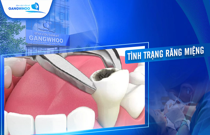 Quá Trình Lành Thương Sau Nhổ Răng