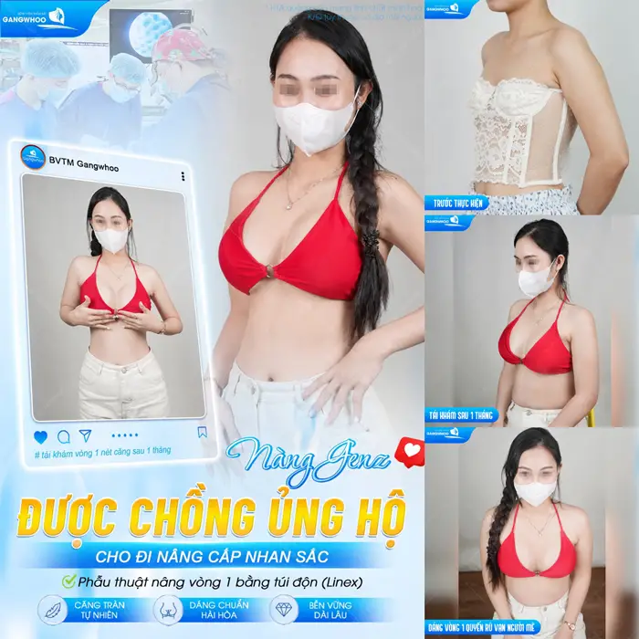 Nàng GenZ được chồng ủng hộ cho đi nâng cấp nhan sắc và body thêm nuột nà và quyến rũ