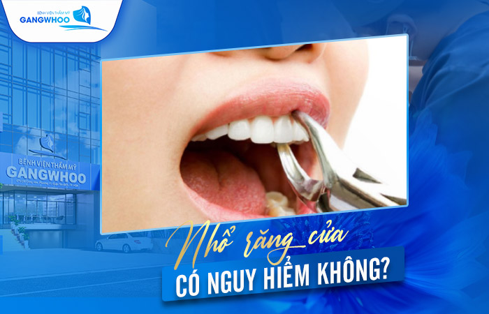 Nhổ Răng Cửa Có Nguy Hiểm Không? Địa Chỉ Nhổ Răng An Toàn 1 Nhổ Răng Cửa Có Nguy Hiểm Không