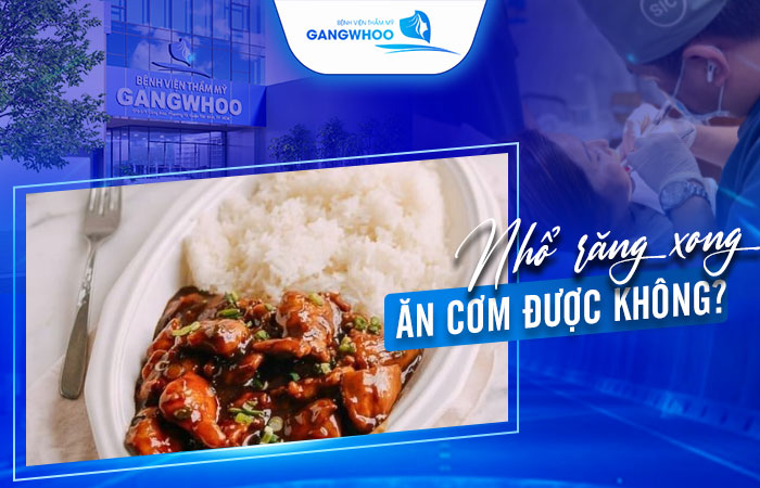 Nhổ Răng Xong Ăn Cơm Được Không