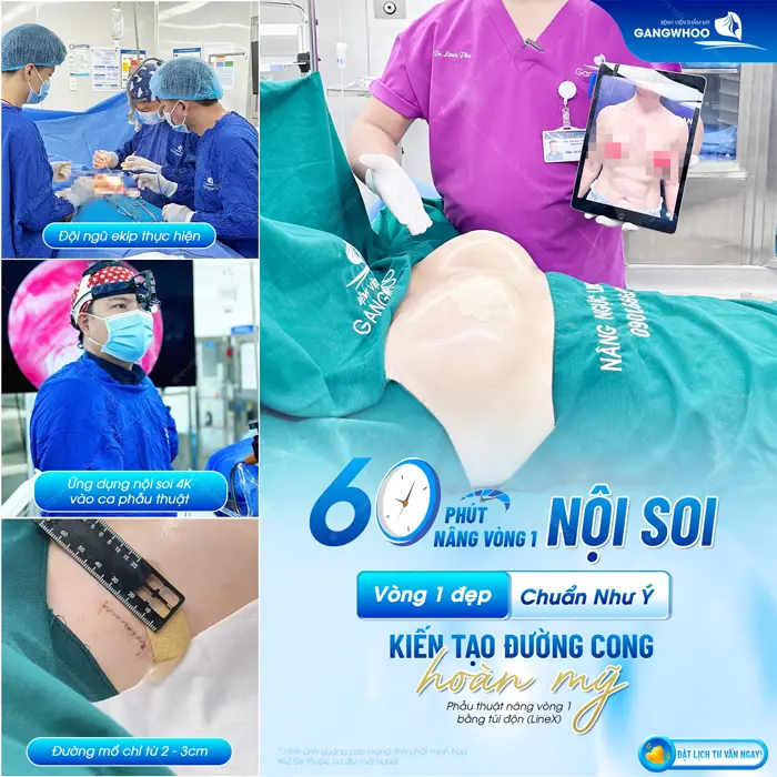 60 phút nội soi nâng vòng 1 vòng 1 đẹp chuẩn ý kiến tạo đường cong hoàn mỹ