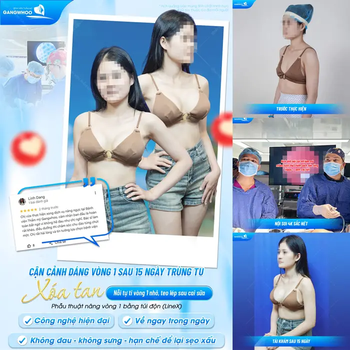 Cận cảnh dáng vòng 1 sau 15 ngày trùng tu xóa tan nỗi tự tin vòng 1 teo lép