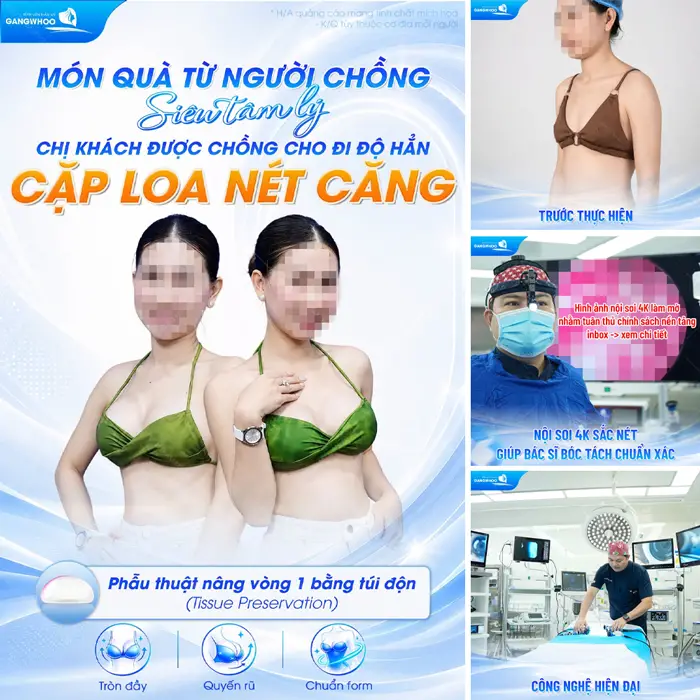 Được chồng cho đi độ loa còn gì hạnh phúc hơn khi sau phẫu thuật body đẹp đầy cuốn hút
