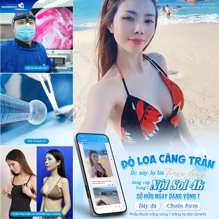 Phẫu thuật nâng cấp còng 1 nội soi tự tin khoe sắc vóc bốc lửa chào hè cực cháy