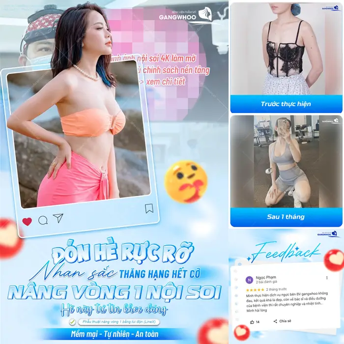 Đón hè rực rỡ nhan sắc đẹp thăng hạng hết cỡ sau nâng vòng 1 nội soi khách hàng hài lòng khoe sắc vóc mới