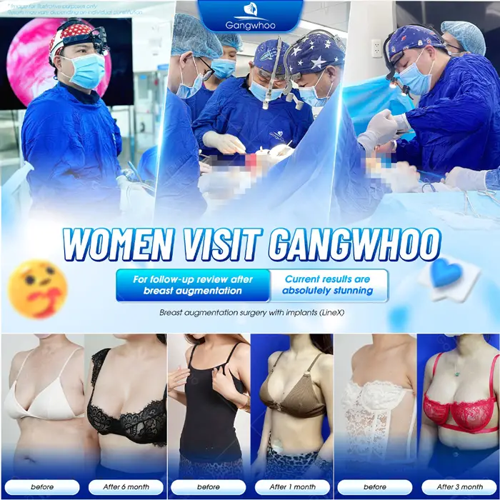 en bang gia nang nguc 3