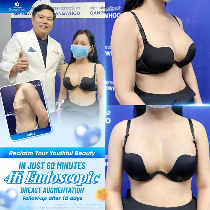 en bang gia nang nguc 4
