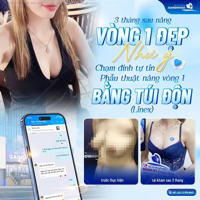 Sau 3 tháng nâng vòng 1 nhan sắc đẹp thăng hạng, diện mạo đẹp đầy tự tin và cuốn hút