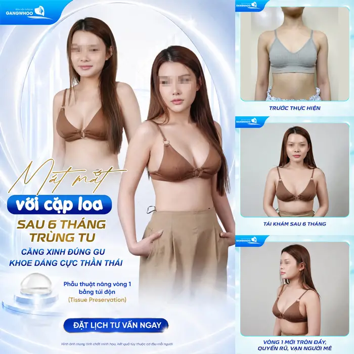 Kết quả sau 6 tháng trùng tu vòng 1 nhan sắc và body đẹp thăng hạng và đầy cuốn hút