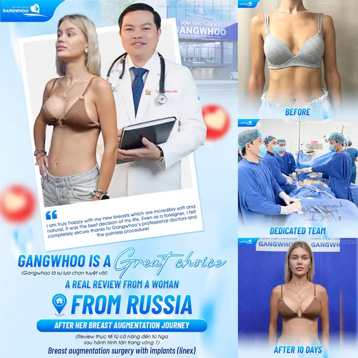 Khách hàng đến từ Nga hài lòng sau phẫu thuật nâng cấp vòng 1 tại BVTM Gangwhoo