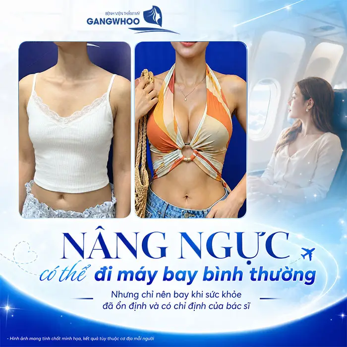 Nâng Ngực Có Đi Máy Bay Được Không? Bao Lâu Đi Được 1 Nâng Ngực Có Đi Máy Bay Được Không? Bao Lâu Đi Được