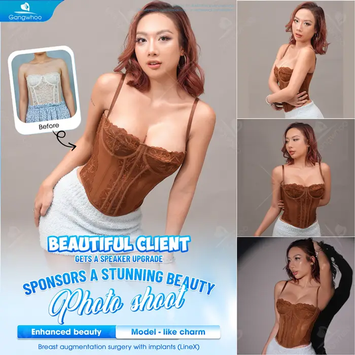 nang nguc noi soi co dau khong 2