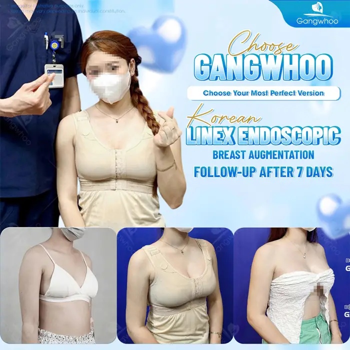 nang nguc noi soi co dau khong 3