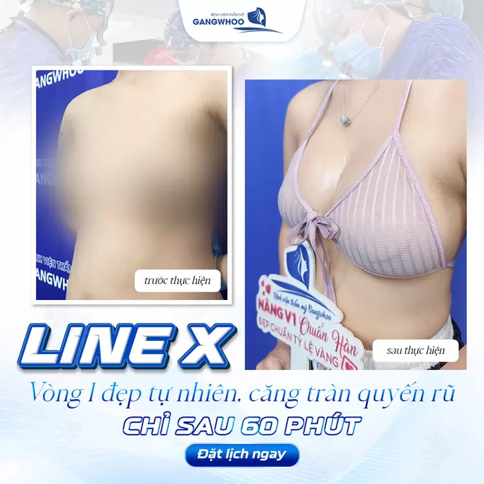 3+ Phương Pháp Nâng Ngực Tự Nhiên Không Phẫu Thuật Chuẩn Hàn 2 Vòng 1 đẹp tự nhiên, căng tràn quyến rũ chỉ sau 60 phút thực hiện