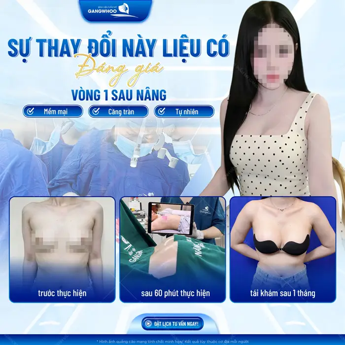 Nâng Ngực Nội Soi Ở Đâu Tốt? 10 Địa Chỉ Tốt Ở TPHCM 16 Sự thay đổi đáng giá vô cùng xứng đáng tự tin hơn với vòng 1 căng tròn, mềm mại, dài lâu