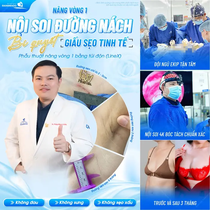Top 15 Bác Sĩ Nâng Ngực Giỏi Tại TPHCM Nhiều Người Biết Đến 4 Nâng vòng 1 nội soi đường nách bí quyết giấu sẹo tinh tế kết quả sau 3 tháng diện mạo đã hoàn toàn thăng hạng