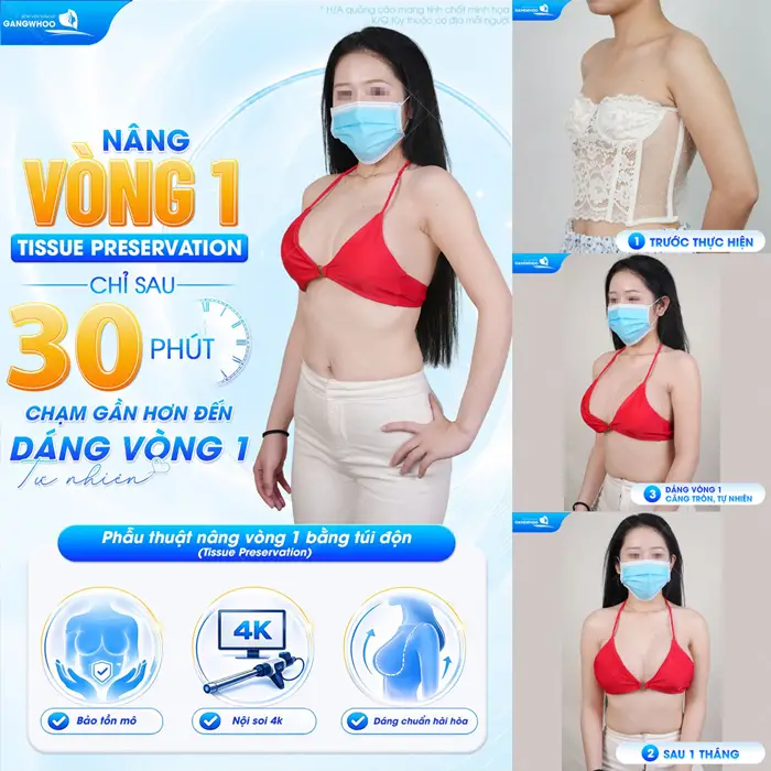 Nâng vòng 1 nhẹ nhàng chỉ sau 30 phút  đã có body đẹp chấn động 