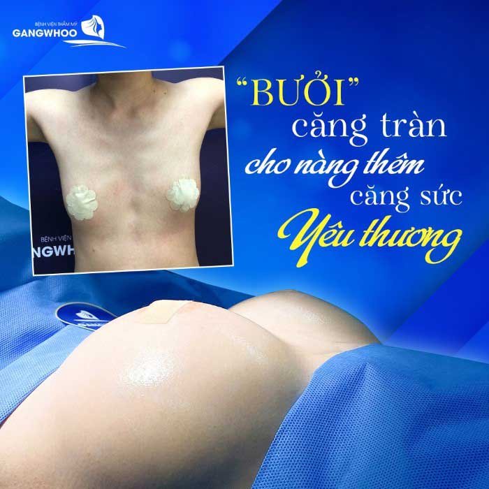 breast augmentation process at Gangwhoo Cosmetic Hospital