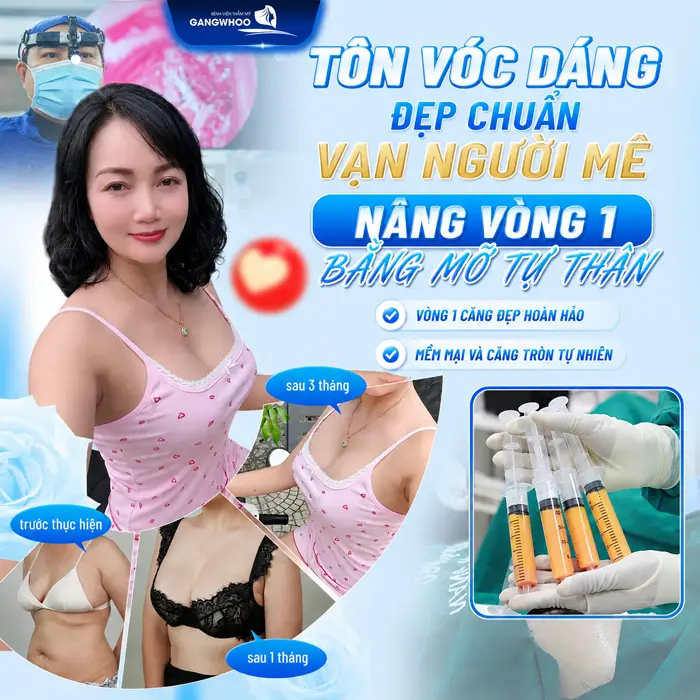 Quy Trình Nâng Ngực Bằng Mỡ Tự Thân? Chi Tiết Trong 6 Bước