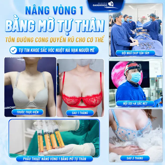 Quy Trình Nâng Ngực Bằng Mỡ Tự Thân? Chi Tiết Trong 6 Bước