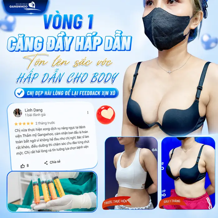 Quy Trình Nâng Ngực Bằng Mỡ Tự Thân? Chi Tiết Trong 6 Bước