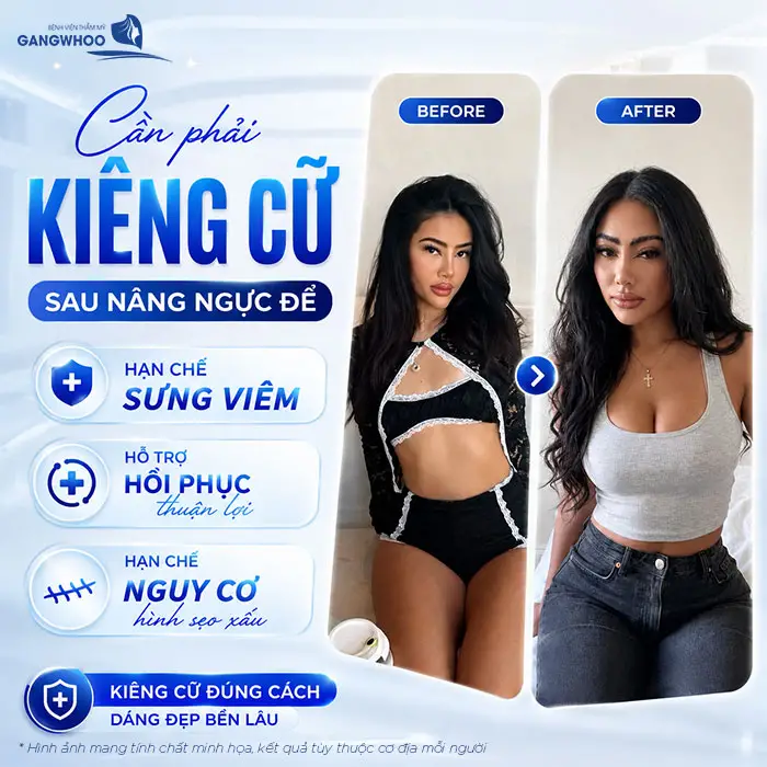 Sau Nâng Ngực Kiêng Ăn Bao Lâu? 8 Thực Phẩm Cần Kiêng