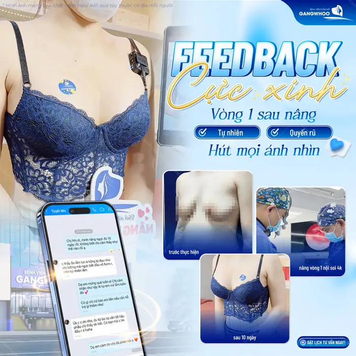 Nâng Ngực Nội Soi Ở Đâu Tốt? 10 Địa Chỉ Tốt Ở TPHCM 19 Feedback cực xinh sau nâng vòng 1 vừa tự tin vừa quyến rũ sau 10 ngày tân trang vòng 1