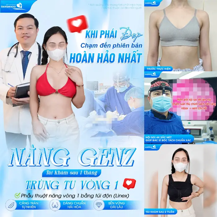 Nâng Ngực Nội Soi Ảnh Hưởng Gì Không? Bác Sĩ Giải Đáp 2 Khi phái đẹp chuẩn sắc vóc sau 1 tháng tái khám đã thăng hạng body thêm phần cuốn hút